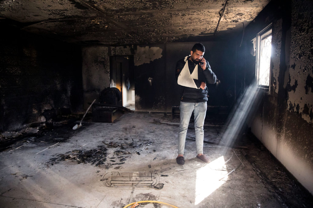 A man with his arm in a sling talks on a telephone while standing in the burnt remains of what was once an apartment